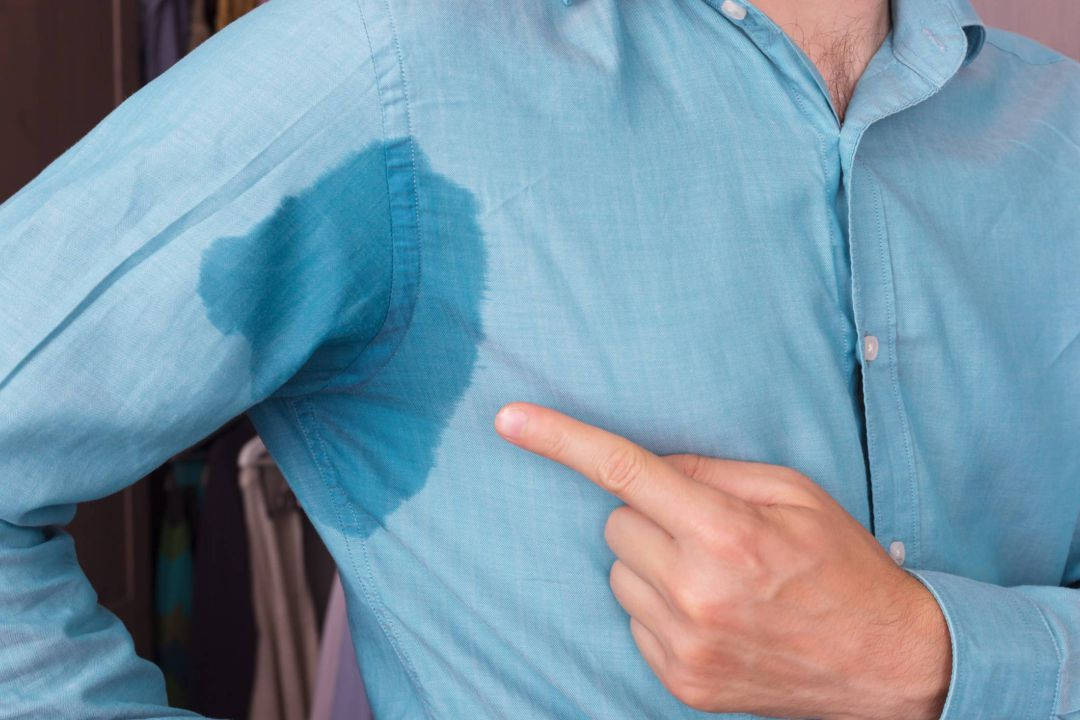 Tratamento de Hiperidrose