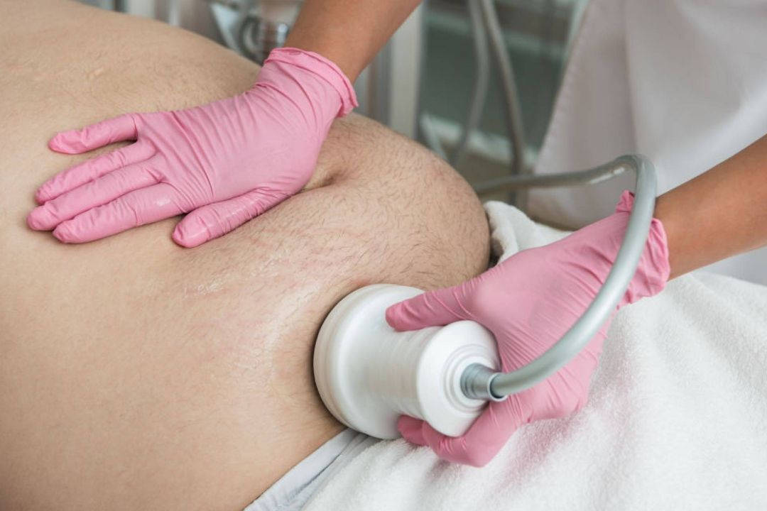 Tratamento de Lipocavitação