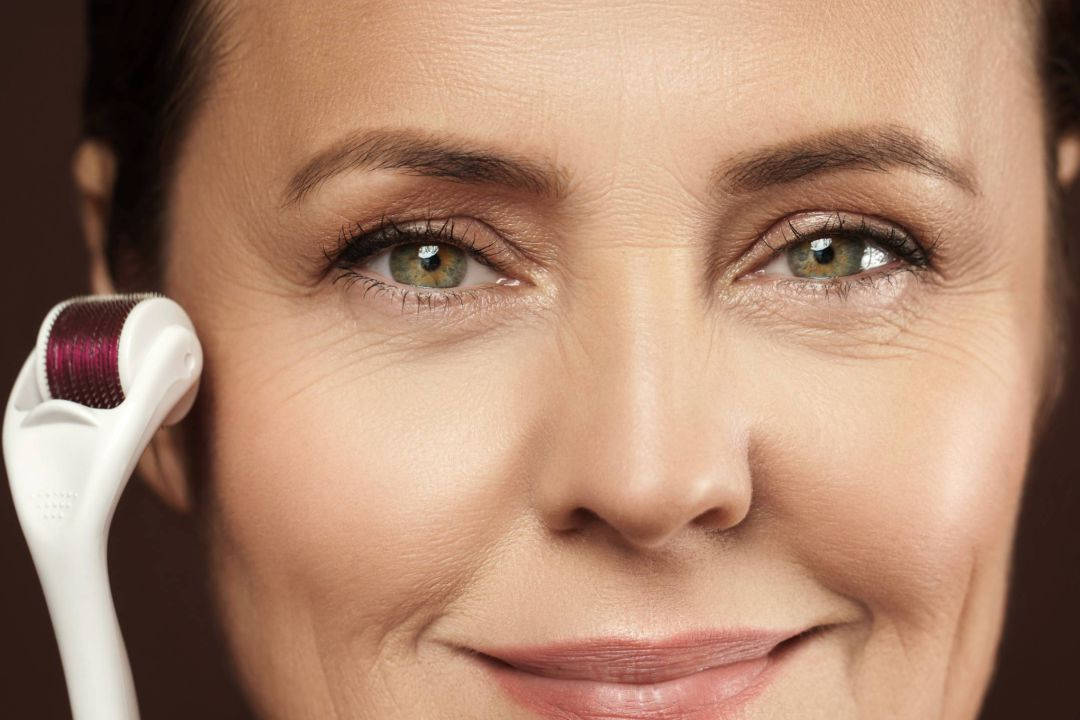 Tratamento de Microagulhamento